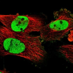 SCC112 Antibody, Novus Biologicals:Antibodies:Primary Antibodies